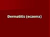 Dermatitis (eczema)