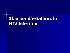 Skin manifestations in HIV infection